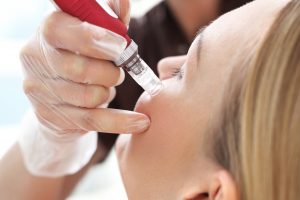 Microneedling can stimulate the skin's natural healing process.