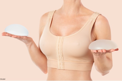 Woman wearing a compression bra holding up a breast implant in each hand