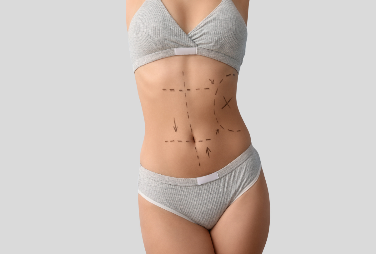 Power-Assisted Liposuction